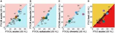 Longitudinal observations of the effects of ischemic stroke on binaural perception